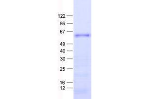 Western Blotting (WB) image for Zinc Finger Protein 582 (ZNF582) protein (His tag) (ABIN2736077)