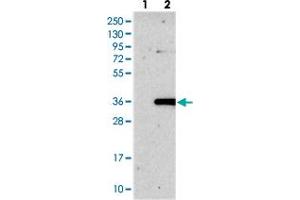 Western blot analysis of Lane 1: Negative control (vector only transfected HEK293T lysate), Lane 2: Over-expression Lysate (Co-expressed with a C-terminal myc-DDK tag (~3. (ROGDI 抗体)