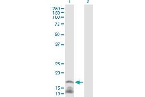 Western Blot analysis of CAMP expression in transfected 293T cell line by CAMP MaxPab polyclonal antibody. (Cathelicidin 抗体  (AA 1-170))