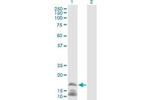 Western Blot analysis of CAMP expression in transfected 293T cell line by CAMP MaxPab polyclonal antibody.