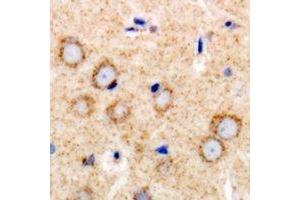 Immunohistochemical analysis of TGFBR2 staining in human brain formalin fixed paraffin embedded tissue section. (TGFBR2 抗体)