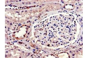 Immunohistochemistry of paraffin-embedded human kidney tissue using ABIN7156864 at dilution of 1:100 (IL23R 抗体  (AA 15-125))