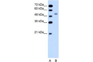 SLC12A1 anticorps  (N-Term)