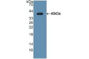 Detection of Recombinant UNG, Human using Polyclonal Antibody to Uracil DNA Glycosylase (UNG) (UNG 抗体  (AA 1-313))