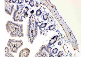IHC analysis of Bax using anti-Bax antibody . (BAX 抗体  (N-Term))