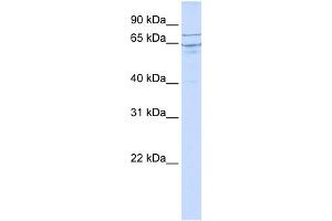 WB Suggested Anti-EDEM1 Antibody Titration:  0. (EDEM1 抗体  (N-Term))