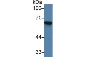 Western blot analysis of Rat Kidney lysate, using Mouse TREH Antibody (2 µg/ml) and HRP-conjugated Goat Anti-Rabbit antibody ( (TREH 抗体  (AA 151-411))