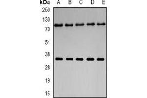 Western blot analysis of Neuroglobin expression in U251 (A), mouse liver (B), mouse brain (C), rat liver (D), rat brain (E) whole cell lysates. (Neuroglobin 抗体)