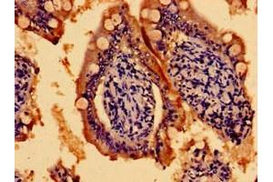 Immunohistochemistry of paraffin-embedded human small intestine tissue using ABIN7159092 at dilution of 1:100 (TMEM67 抗体  (AA 241-500))