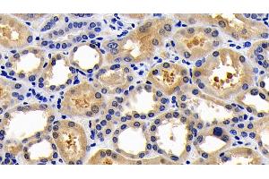 Detection of CASP1 in Human Kidney Tissue using Polyclonal Antibody to Caspase 1 (CASP1) (Caspase 1 抗体  (AA 317-404))