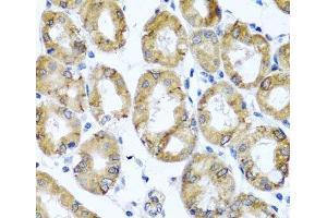 Immunohistochemistry of paraffin-embedded Human stomach using M6PR Polyclonal Antibody at dilution of 1:100 (40x lens). (M6PR 抗体)
