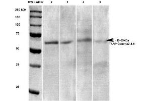 Western Blot analysis of Rat brain lysates showing detection of Stargazin Calcium Channel protein using Mouse Anti-Stargazin Calcium Channel Monoclonal Antibody, Clone S245-36 . (Stargazin 抗体  (AA 203-323) (HRP))