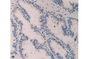 IHC-P analysis of Human Prostate Gland Tissue, with DAB staining. (Contactin 4 抗体  (AA 731-980))