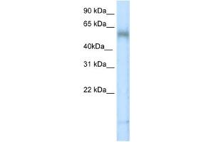 WB Suggested Anti-TBX6 Antibody   Titration: 5 ug/ml   Positive Control: Placenta (T-Box 6 抗体  (N-Term))