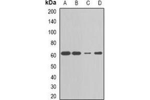 Western blot analysis of CBX4 expression in MCF7 (A), HepG2 (B), Jurkat (C), mouse liver (D) whole cell lysates. (CBX4 抗体)