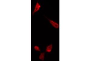ABIN6266485 staining K562 by IF/ICC. (ENOS 抗体  (C-Term))