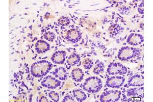 Formalin-fixed and paraffin embedded mouse intestine labeled with Rabbit Anti Phospho-Talin (Ser425) Polyclonal Antibody, Unconjugated (ABIN703135) at 1:200 followed by conjugation to the secondary antibody and DAB staining (Talin 抗体  (pSer425))