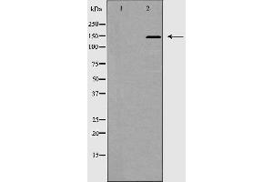 Western blot analysis of ACE1 expression in mouse kidney,The lane on the left is treated with the antigen-specific peptide. (Angiotensin I Converting Enzyme 1 抗体  (Internal Region))