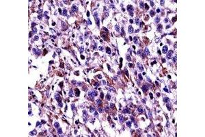 Oct-2 antibody immunohistochemistry analysis in formalin fixed and paraffin embedded human testis carcinoma. (Oct-2 抗体  (AA 10-39))