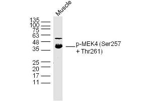 Mouse Muscle lysates probed with p-MEK4(Ser257 + Thr261) Polyclonal Antibody, Unconjugated  at 1:300 dilution and 4˚C overnight incubation. (MAP2K4 抗体  (pSer257, pThr261))