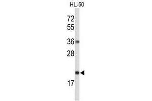 Western blot analysis of RNH2C Antibody (Center) in HL-60 cell line lysates (35µg/lane). (RNASEH2C 抗体  (Middle Region))