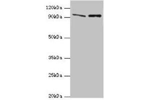 Western blot All lanes: NVL antibody at 10 μg/mL Lane 1: Mouse thymus tissue Lane 2: Hela whole cell lysate Secondary Goat polyclonal to rabbit IgG at 1/10000 dilution Predicted band size: 96, 83, 73, 74, 86 kDa Observed band size: 96 kDa (NVL 抗体  (AA 340-520))