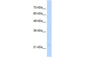 Western Blotting (WB) image for anti-Nudix (Nucleoside Diphosphate Linked Moiety X)-Type Motif 16-Like 1 (NUDT16L1) antibody (ABIN2463181)