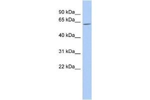 WB Suggested Anti-TULP2 Antibody Titration:  0. (TULP2 抗体  (Middle Region))