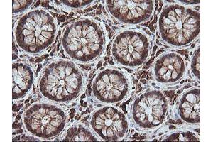 Image no. 1 for anti-Melanoma Antigen Family A, 4 (MAGEA4) antibody (ABIN1499260) (MAGEA4 抗体)