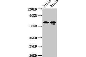 Western Blot Positive WB detected in: Rat brain tissue, Mouse brain tissue All lanes: STXBP1 antibody at 2 μg/mL Secondary Goat polyclonal to rabbit IgG at 1/50000 dilution Predicted band size: 68, 69 kDa Observed band size: 68, 69 kDa (STXBP1 抗体  (AA 245-594))