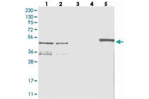 Western blot analysis of Lane 1: RT-4, Lane 2: U-251 MG, Lane 3: Human Plasma, Lane 4: Liver, Lane 5: Tonsil with ZNF641 polyclonal antibody  at 1:250-1:500 dilution. (ZNF641 抗体)