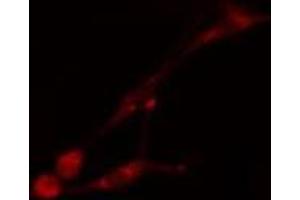 ABIN6275510 staining HT29 cells by IF/ICC. (PHAX 抗体  (Internal Region))