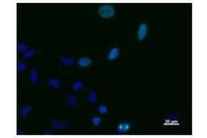 Immunostaining analysis in HeLa cells. (TPX2 抗体)