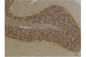 Immunohistochemistry (IHC) image for anti-Potassium Intermediate/small Conductance Calcium-Activated Channel, Subfamily N, Member 2 (KCNN2) antibody (ABIN3188066)