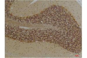 Immunohistochemistry (IHC) analysis of paraffin-embedded Human Brain Tissue using KCNN2(SK2) Rabbit Polyclonal Antibody diluted at 1:200. (KCNN2 抗体)