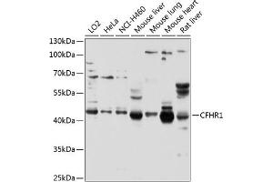 Western blot analysis of extracts of various cell lines, using CFHR1 antibody (ABIN3016580, ABIN3016581, ABIN3016582 and ABIN6219787) at 1:1000 dilution. (CFHR1 抗体  (AA 151-330))