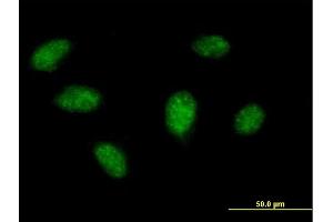 Immunofluorescence of purified MaxPab antibody to BIRC4BP on HeLa cell. (XAF1 抗体  (AA 1-301))