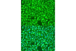 Immunohistochemistry of paraffin-embedded rat heart using NFKB2 Antibody (ABIN1873900) at dilution of 1:100 (40x lens). (NFKB2 抗体)