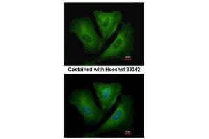 Immunofluorescence (IF) image for anti-Major Histocompatibility Complex, Class II, DR beta 3 (HLA-DRB3) antibody (ABIN2856027)