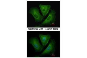 ICC/IF Image Immunofluorescence analysis of methanol-fixed A549, using HLA-DRB3, antibody at 1:500 dilution. (HLA-DRB3 抗体)
