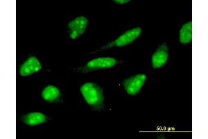Immunofluorescence of monoclonal antibody to ZNF396 on HeLa cell. (ZNF396 抗体  (AA 131-230))