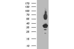 Western Blotting (WB) image for anti-Pleckstrin Homology Domain Containing Family A3 (PLEKHA3) antibody (ABIN1500275) (PLEKHA3 抗体)