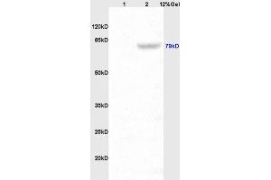 Lane 1: rat kidney lysates Lane 2: mouse intestine lysates probed with Anti P-cadherin Polyclonal Antibody, Unconjugated (ABIN738531) at 1:200 in 4 °C. (P-Cadherin 抗体  (AA 625-725))