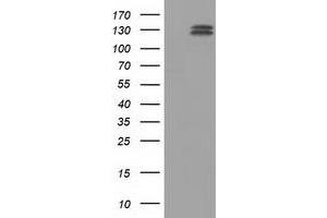 Western Blotting (WB) image for anti-L1 Cell Adhesion Molecule (L1CAM) antibody (ABIN1499085) (L1CAM 抗体)