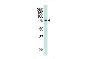 The anti-GRK3 Pab (ABIN390986 and ABIN2841169) is used in Western blot to detect GRK3 in mouse heart tissue lysate. (AD_K2 (AA 633-660), (C-Term) 抗体)