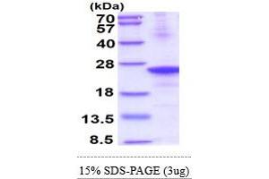 SDS-PAGE (SDS) image for C-Type Lectin Domain Family 4, Member E (CLEC4E) (AA 41-219) protein (His tag) (ABIN5854155) (CLEC4E Protein (AA 41-219) (His tag))