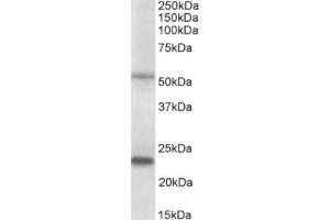Western Blotting (WB) image for anti-Matrix Metallopeptidase 3 (Stromelysin 1, Progelatinase) (MMP3) (AA 459-473), (C-Term) antibody (ABIN2465159) (MMP3 抗体  (C-Term))