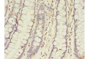 Immunohistochemistry of paraffin-embedded human colon tissue using ABIN7145877 at dilution of 1:100 (BTN2A1 抗体  (AA 29-248))