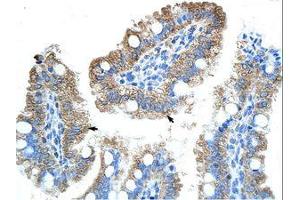 Image no. 1 for anti-Obg-Like ATPase 1 (OLA1) (AA 104-153) antibody (ABIN6736213) (OLA1 抗体  (AA 104-153))