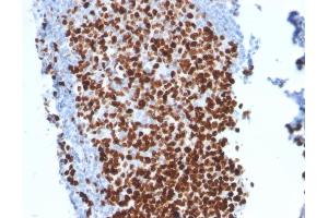 Formalin-fixed, paraffin-embedded human Tonsil stained with Ki67-Monospecific Mouse Monoclonal Antibody (MKI67/2462). (Ki-67 抗体  (AA 2293-2478))
